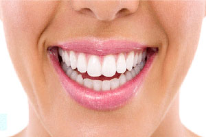 A woman smiling with pink lips, and perfect white teeth