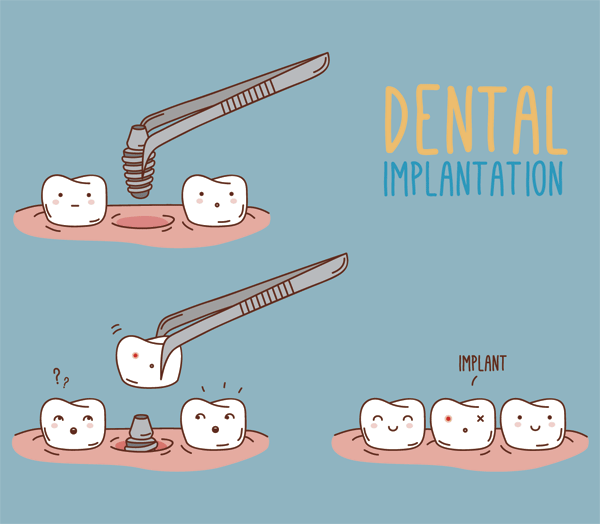 An illustration with a blue background that shows a short summary on what happen during dental implantation