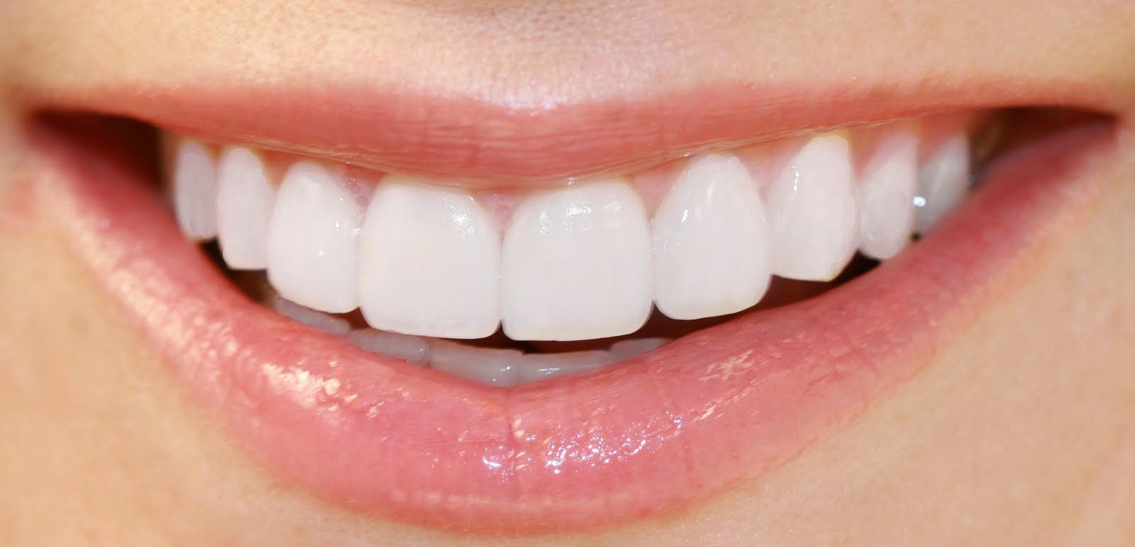 A close up photo of a smile that has perfectly aligned white teeth