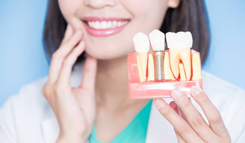Dentist smiling while holding a teeth implant model